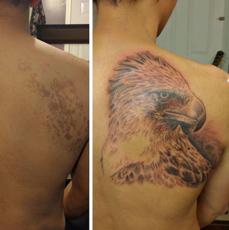 birthmark tattoo cover ups